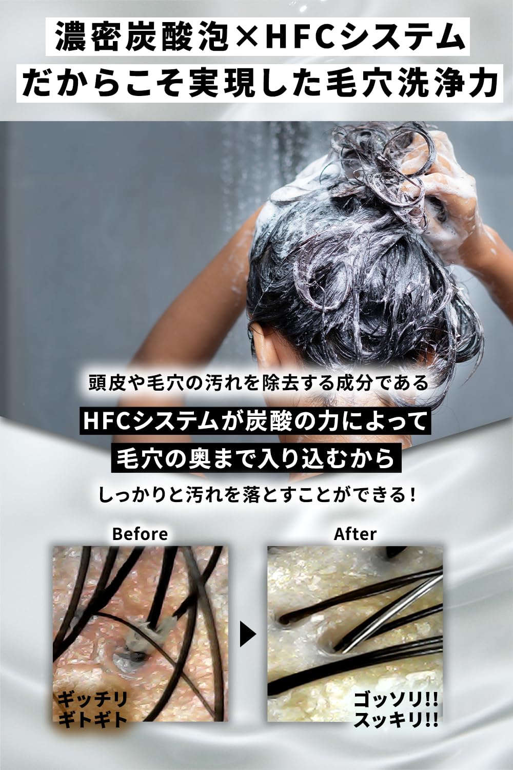 Amazon | 【PALAIS】 炭酸シャンプー （3本セット）スカルプシャンプー